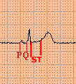 PQ.gif (1988 byte)