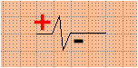 QRSpm.gif (1771 byte)